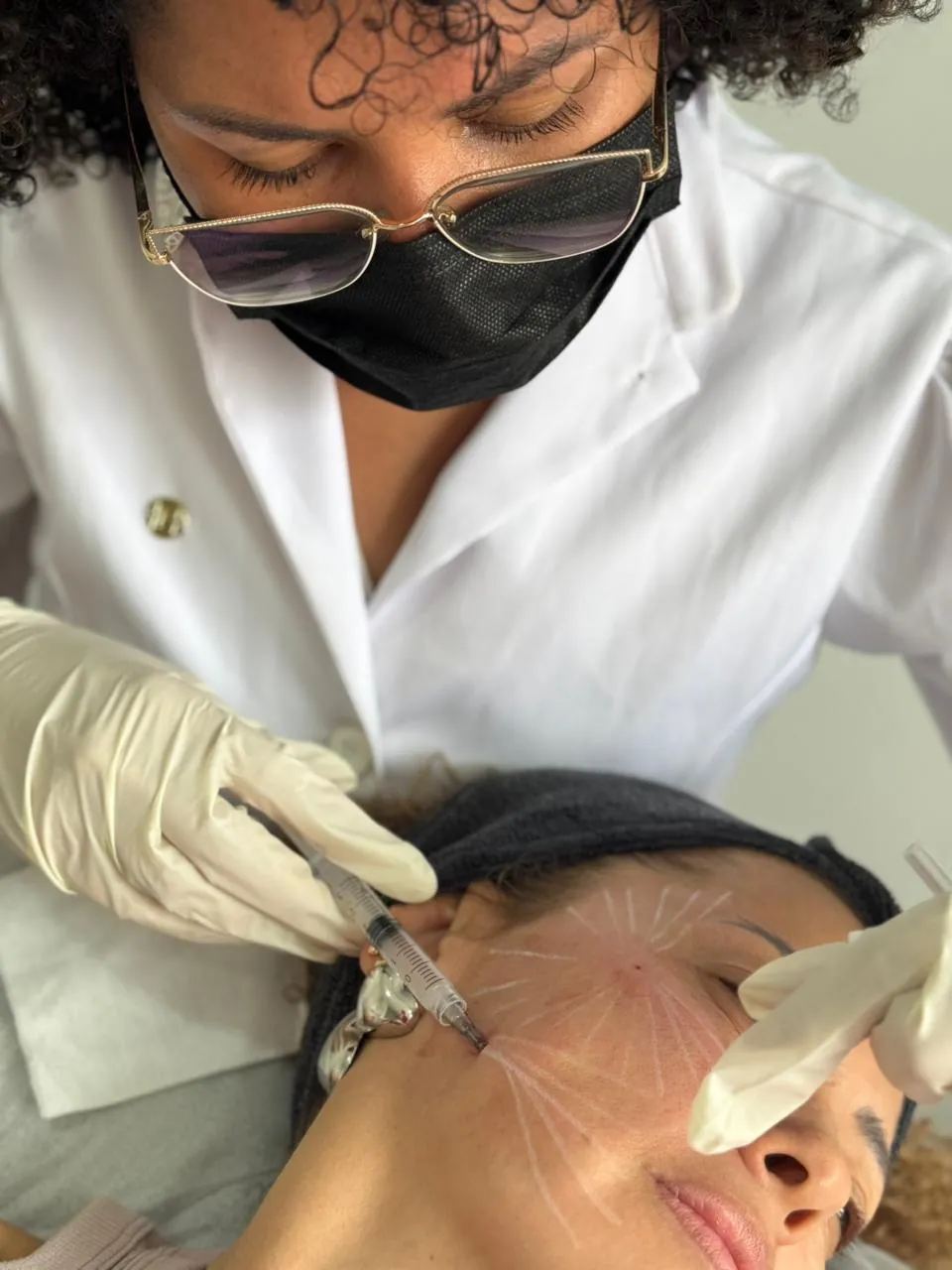 Tratamiento con Bio-estimuladores