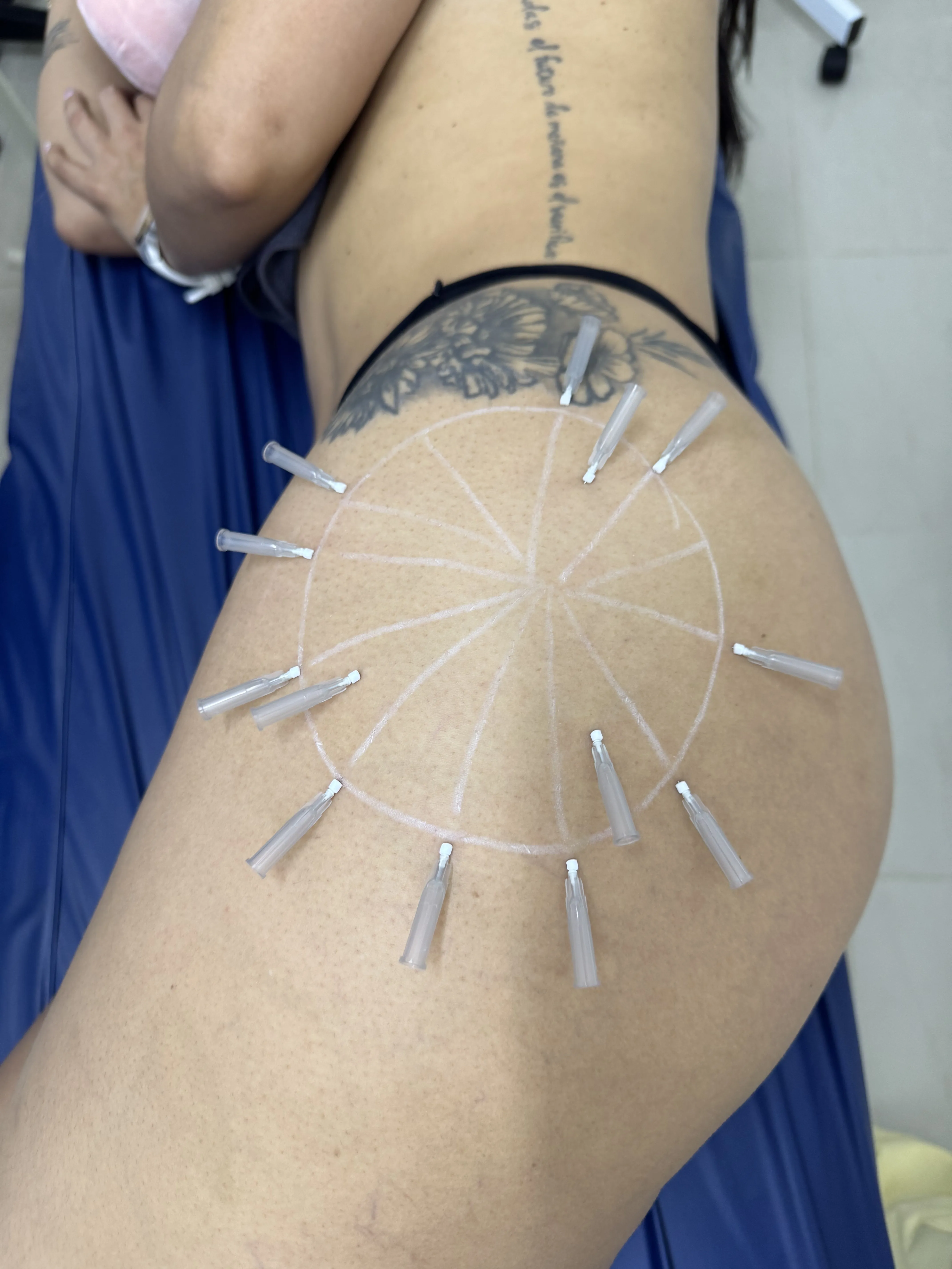 Curso Toxina Botulínica